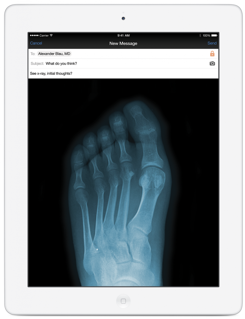 doximity interface showing a message with an attachment of an X-Ray image of a foot that is being sent to another doctor for review